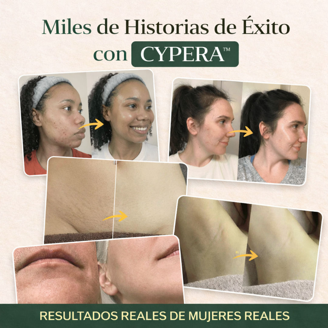 CYPERA™ – Alternativa natural al láser en casa
