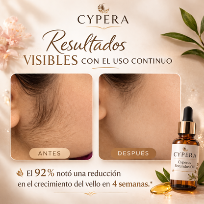 CYPERA™ – Reduce el Crecimiento del Vello Naturalmente