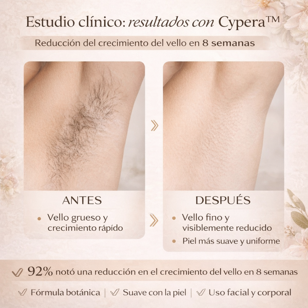 CYPERA™ – Reduce el Crecimiento del Vello Naturalmente