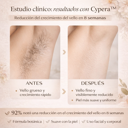 CYPERA™ – Reduce el Crecimiento del Vello Naturalmente