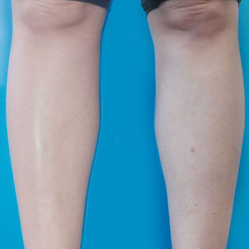 <strong>Laura M., Madrid</strong>